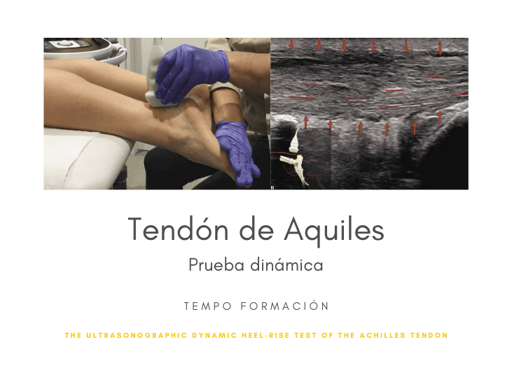 tendon-aquiles-ecografia-valoracion-dinamica